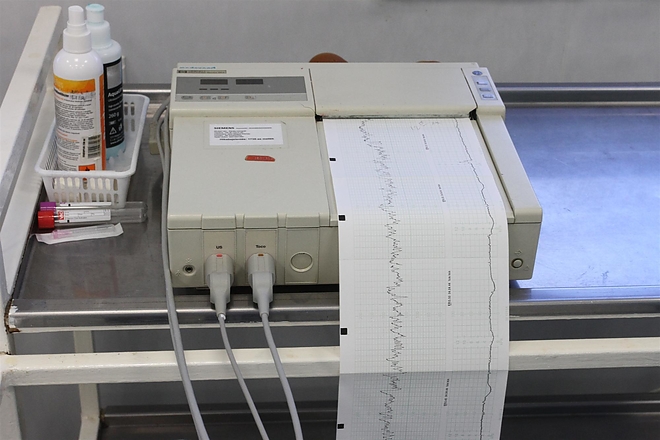 ekg_151022_ja.jpg