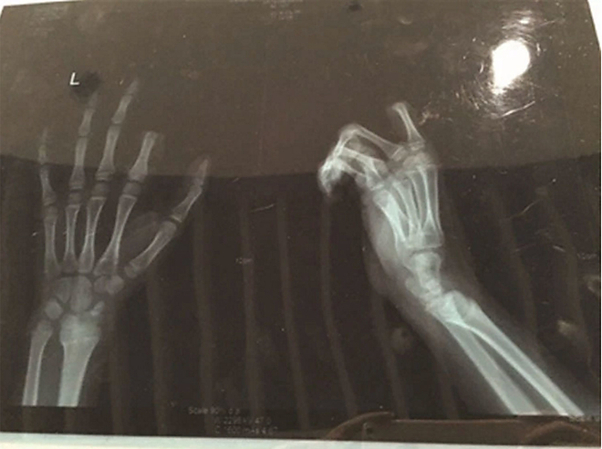 xray_2733333a.jpg xray_2733333a.jpg