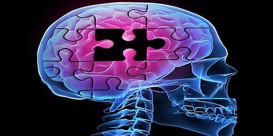 alzheimers-brainpuzzle-560.jpg alzheimers-brainpuzzle-560.jpg