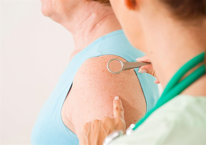 melanoma2.png
