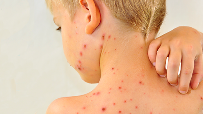 kanyaro.png kanyaro.png