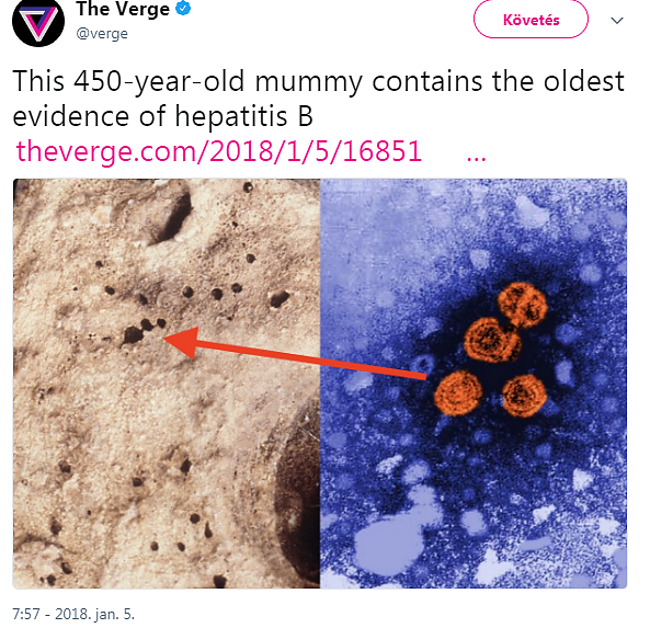 hepatits_b.png hepatits_b.png