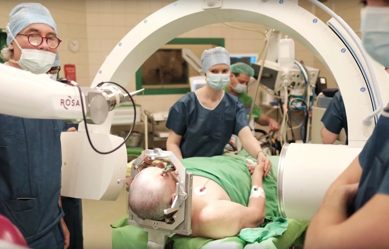 Először végeztek Magyarországon agyműtétet robot segítségével