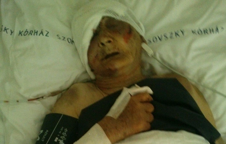 Életveszélyesen bántalmazott egy idős asszonyt egy férfi Lentiben