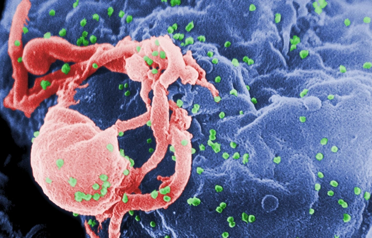 Izraeli orvosok állítják: teljesen el tudják tüntetni a HIV-vírust az emberi szervezetből