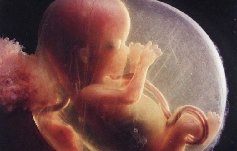 Rendkívül ritka terhesség után születtek ikrei egy brit nőnek